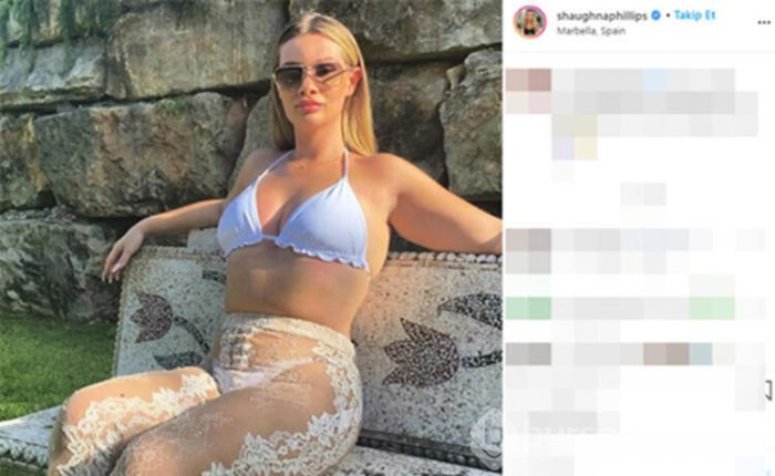Shaughna Phillips baldırlarından yağ aldırdı