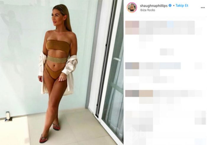 Shaughna Phillips baldırlarından yağ aldırdı