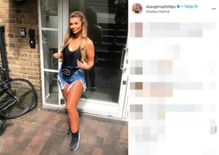 Shaughna Phillips baldırlarından yağ aldırdı