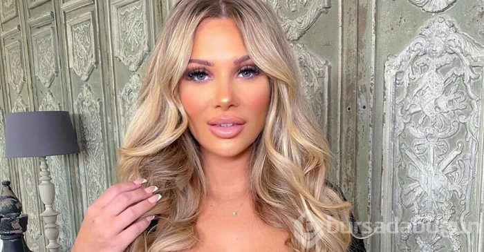 Shaughna Phillips baldırlarından yağ aldırdı
