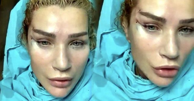 Geçtiğimiz günlerde estetik yaptıran Seda Sayan'ın sosyal medyadaki son paylaşımı olay oldu!
