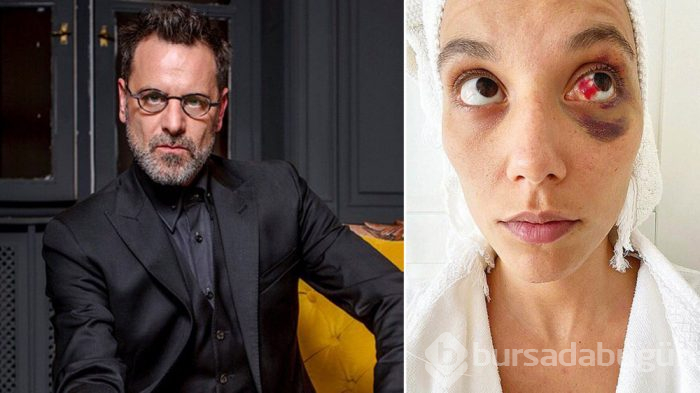 Serenay Sarıkaya'nın sessizliği Deniz Bulutsuz ile olan arkadaşlığını bitirdi