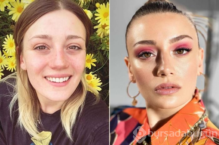 Ünlüler arasındaki yeni trend: Kusursuz doğal görünüm!