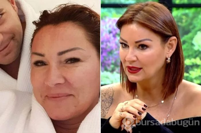 Ünlüler arasındaki yeni trend: Kusursuz doğal görünüm!