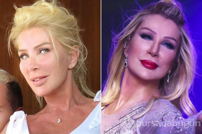 Ünlüler arasındaki yeni trend: Kusursuz doğal görünüm!