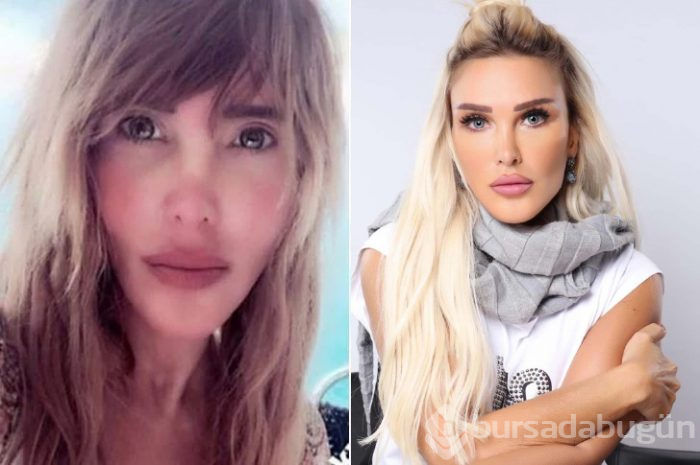 Ünlüler arasındaki yeni trend: Kusursuz doğal görünüm!