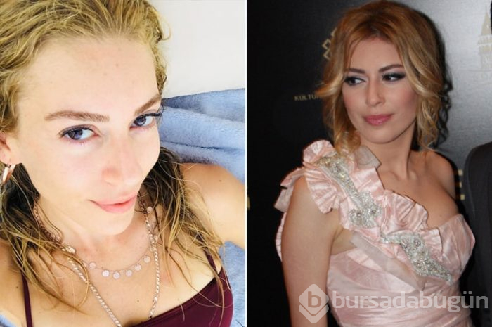 Ünlüler arasındaki yeni trend: Kusursuz doğal görünüm!