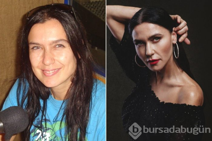 Ünlüler arasındaki yeni trend: Kusursuz doğal görünüm!