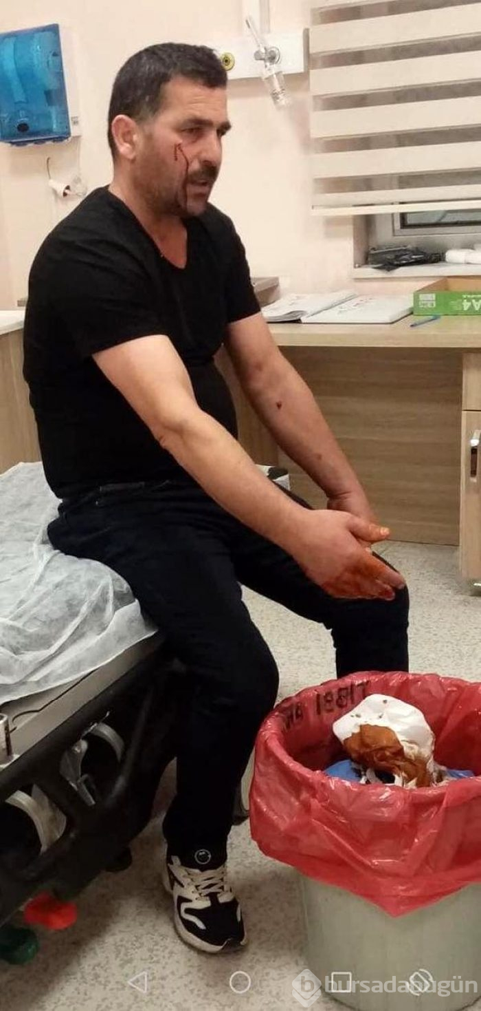 Köpekler için yaktığı torpil elinde patladı!