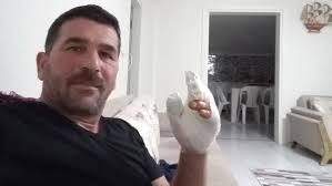 Köpekler için yaktığı torpil elinde patladı!