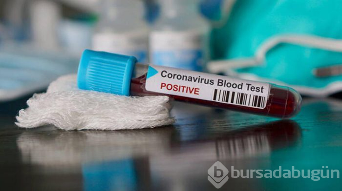 Corona virüs testi evde yapılır mı?
