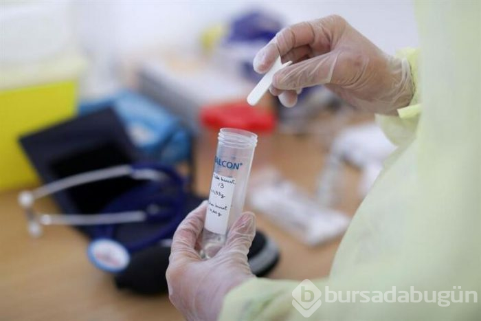 Dikkat! Hangi kan grubunun koronavirüse yakalanma riski daha yüksek?