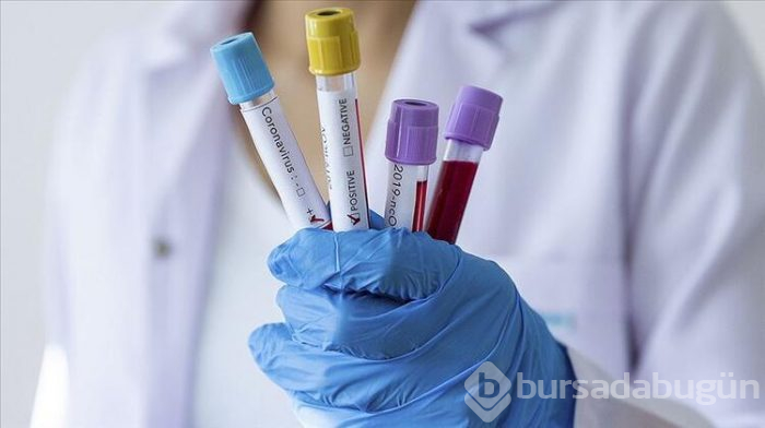 Dikkat! Hangi kan grubunun koronavirüse yakalanma riski daha yüksek?