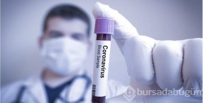 Koronavirüs zeka seviyesini düşürüyor!