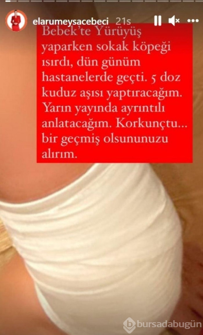 Ela Rumeysa Cebeci: İlk kez köpekten kaçtım ama kurtulamadım