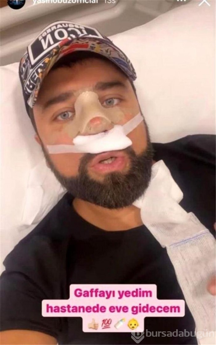 Yasin Obuz burun ameliyatı oldu