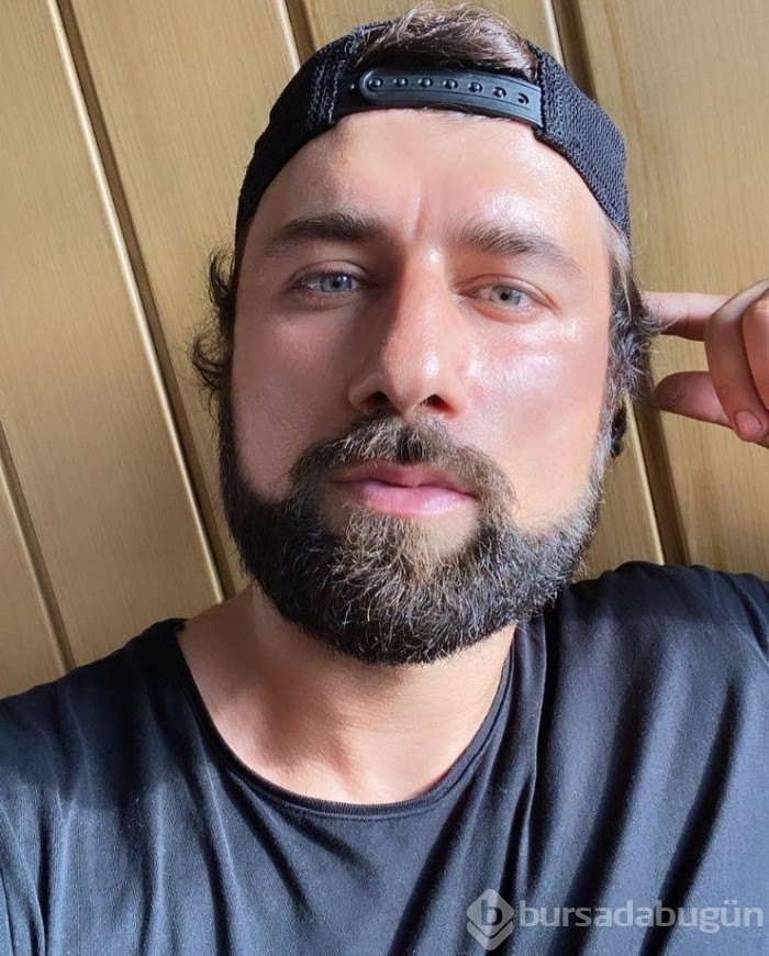 Yasin Obuz burun ameliyatı oldu