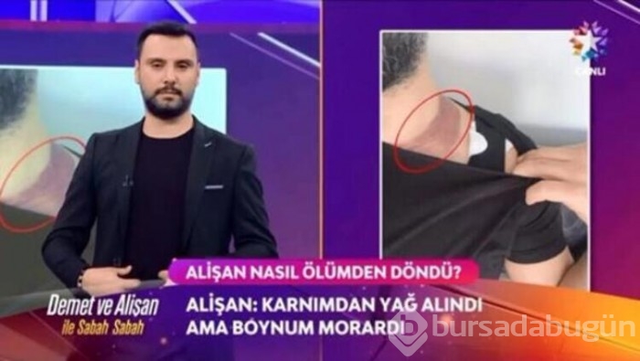 Alişan ölümden döndü!