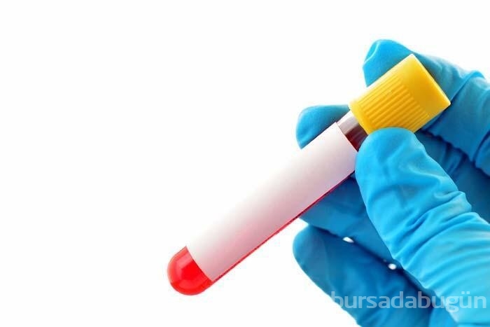 Kansızlığın vücuttaki 5 kritik belirtisi!