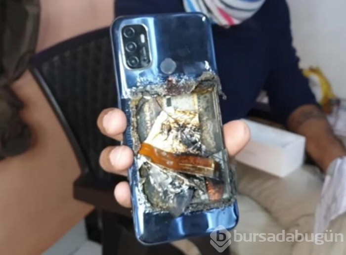 Telefon patladı, çocuk diri diri yandı!