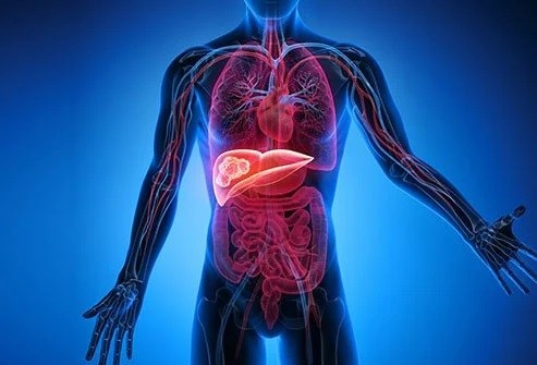 Karaciğerdeki bu yağlanma organ nakline götürebilir