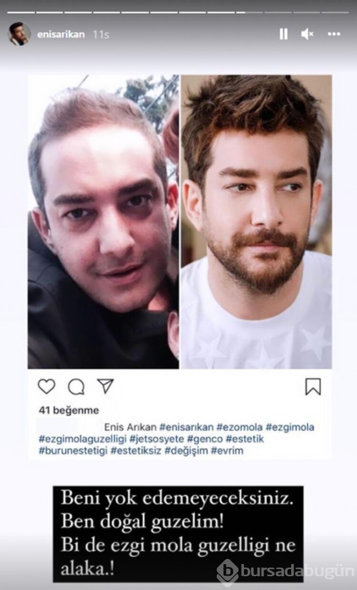 Enis Arıkan'dan 'Ben doğal güzelim' çıkışı!
