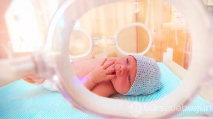 Prematüre retinopatisi her 4 bebekten 1'inde görülüyor!
