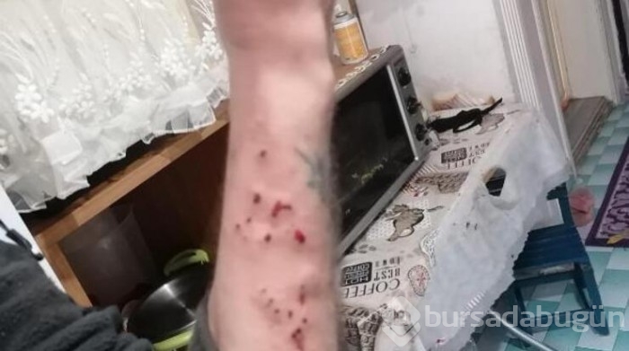 Hurda diye aldığı malzemeler bomba fünyesi çıktı!