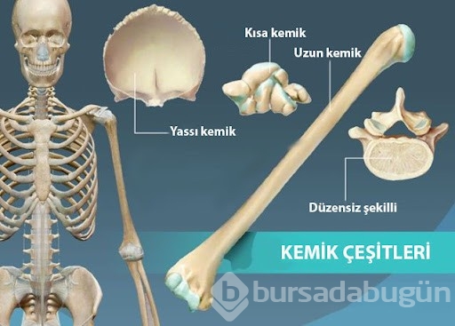 Kemik yapısının zayıflaması kırıklara neden oluyor
