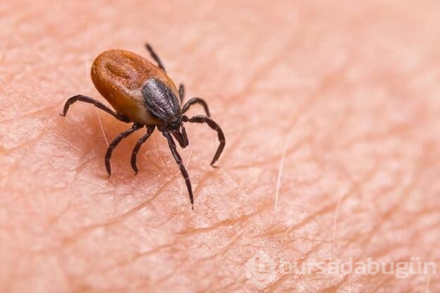 Lyme hastalığı nedir? Nelere dikkat edilmelidir?
