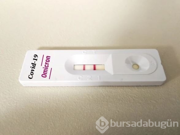 Omicron varyantının bulaşma katsayısı ve yeniden enfeksiyon riski ne kadar?

