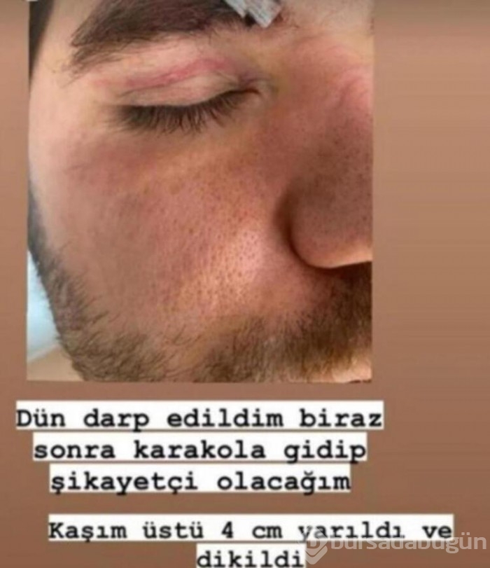 Ceyhun Fersoy-Begüm Öner'e saldırı anı kamerada!