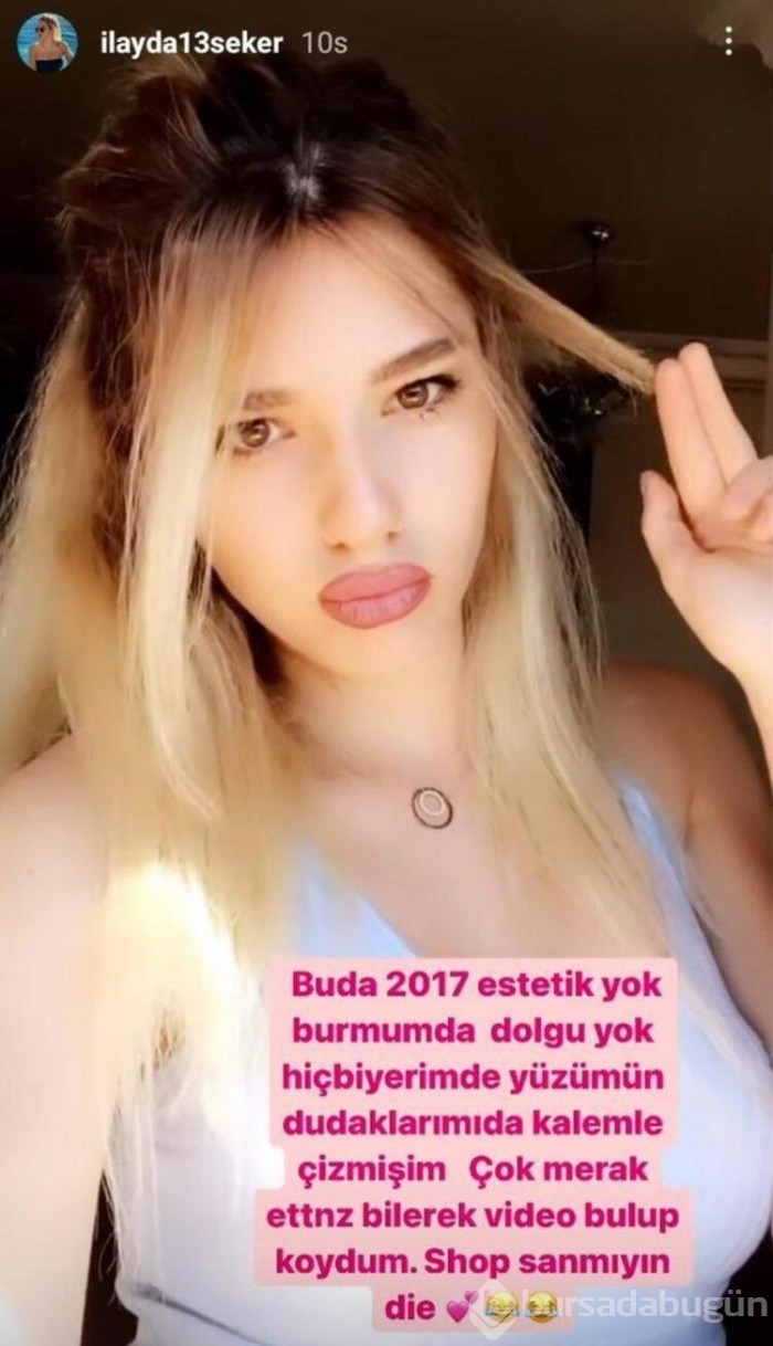İlayda Şeker'in estetiksiz hali şaşırttı....