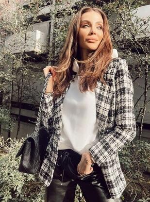 Özge Ulusoy'dan estetik itirafı