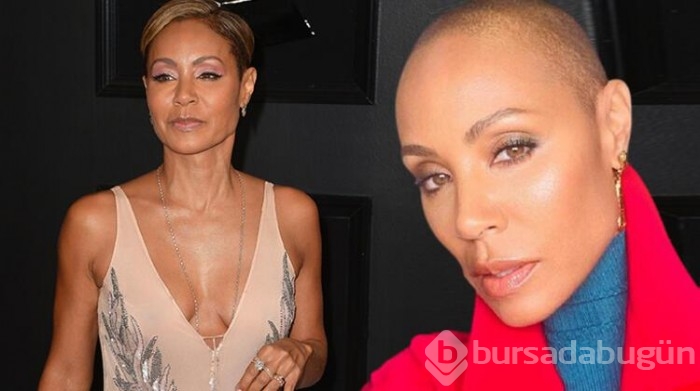 Jada Pinkett Smith sağlık sorununu anlattı