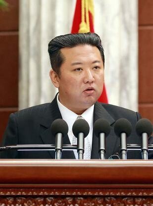 Kim Jong-un bir deri bir kemik kaldı!