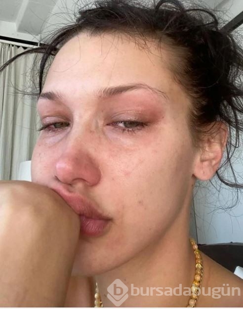 Bella Hadid: Ruh sağlığım için stilistimi bıraktım
