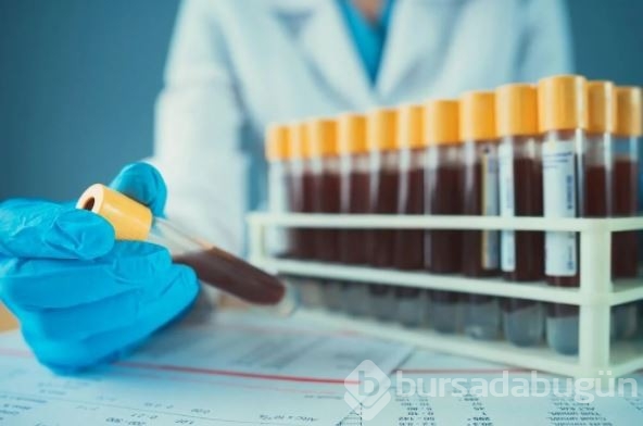 AIDS/HIV ile mücadelede önemli gelişme: Virüsü tamamen ortadan kaldırabilen tedavi geliştirildi