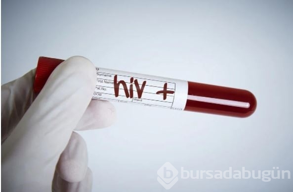 AIDS/HIV ile mücadelede önemli gelişme: Virüsü tamamen ortadan kaldırabilen tedavi geliştirildi