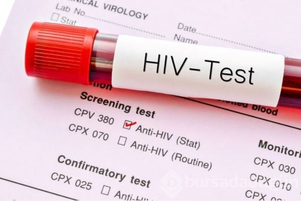 AIDS/HIV ile mücadelede önemli gelişme: Virüsü tamamen ortadan kaldırabilen tedavi geliştirildi