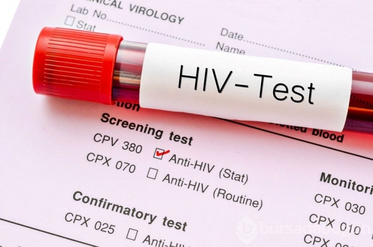 Covid-19 ile enfekte olan AIDS hastası 21 mutasyon geliştirdi