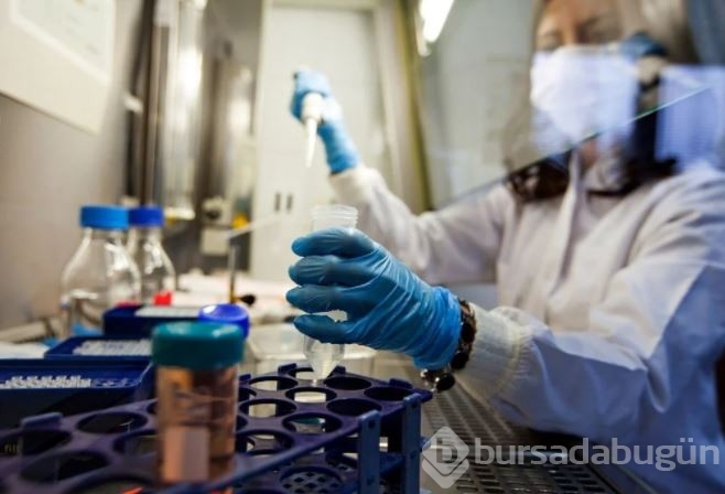Oxford duyurdu: Yeni HIV varyantı AIDS vakalarını iki katına çıkarabilir
