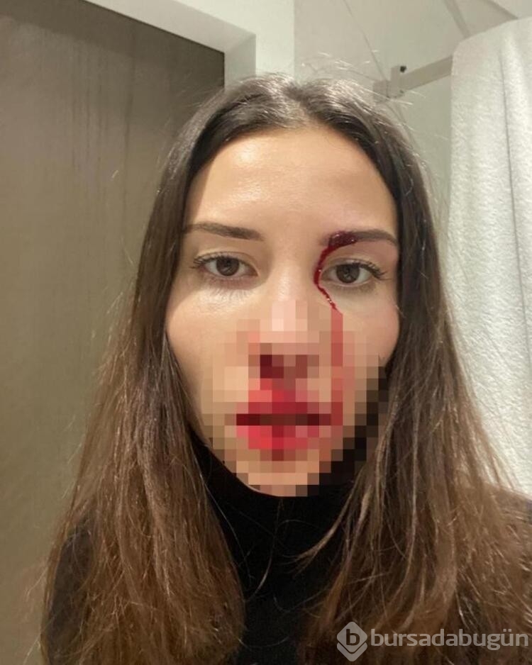Mihriban Hurmacı yaşadığı şiddeti anlattı: Özer beni kendisine muhtaç etti!
