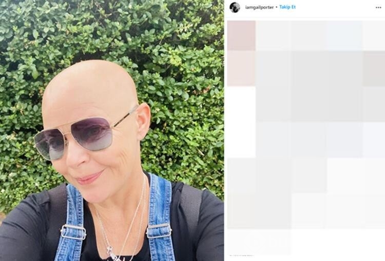 Gail Porter: Beni hiçbir şey yıkamaz!