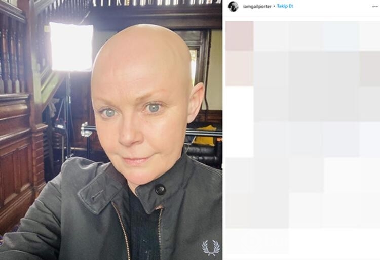 Gail Porter: Beni hiçbir şey yıkamaz!