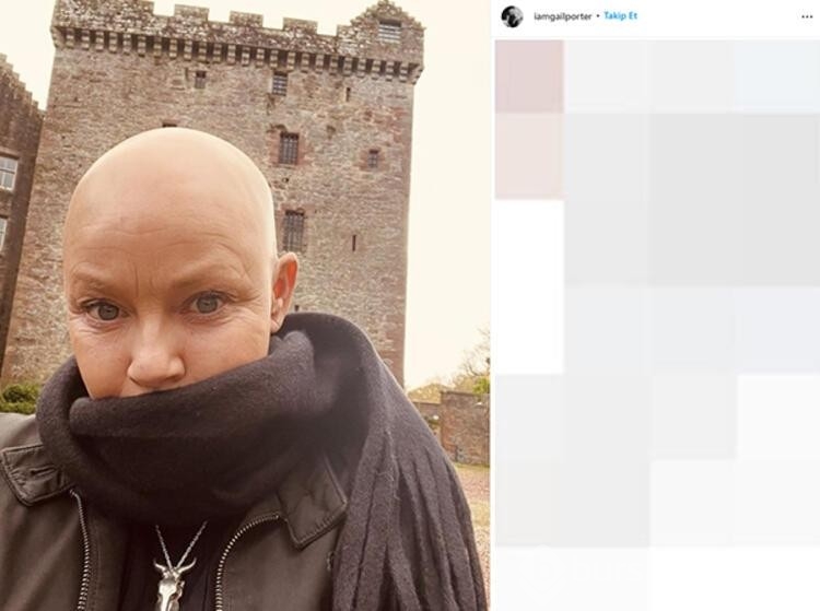 Gail Porter: Beni hiçbir şey yıkamaz!