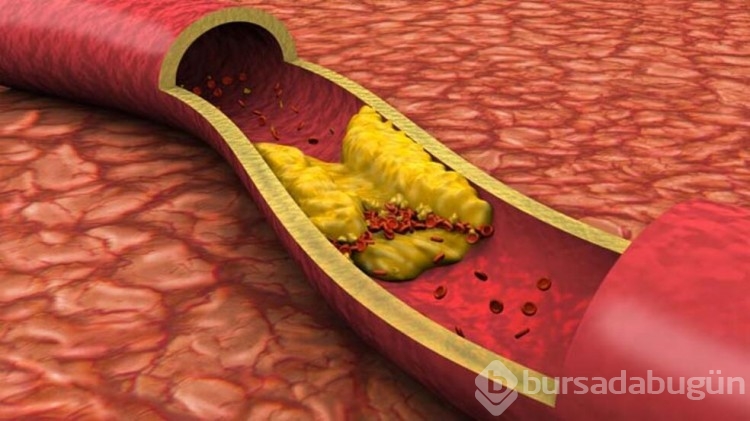 Kolesterolün önemi kanda ortaya çıktı!