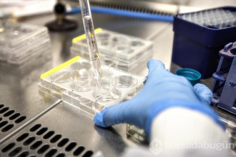 HIV pozitif bir kadın virüsten tamamen kurtuldu!
