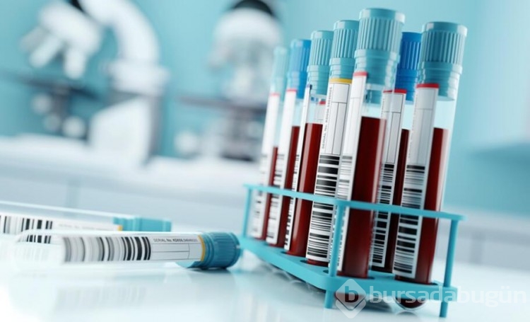 HIV pozitif bir kadın virüsten tamamen kurtuldu!
