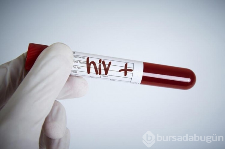 HIV pozitif bir kadın virüsten tamamen kurtuldu!
